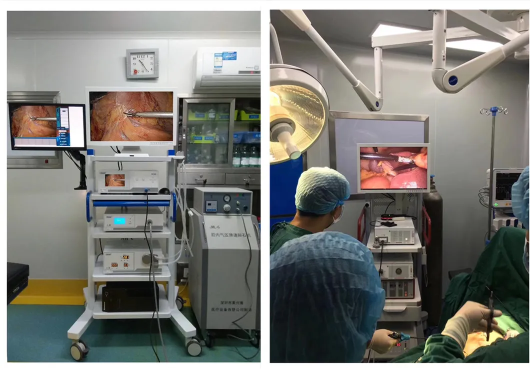15inch Medical Monitor for Ent Imaging