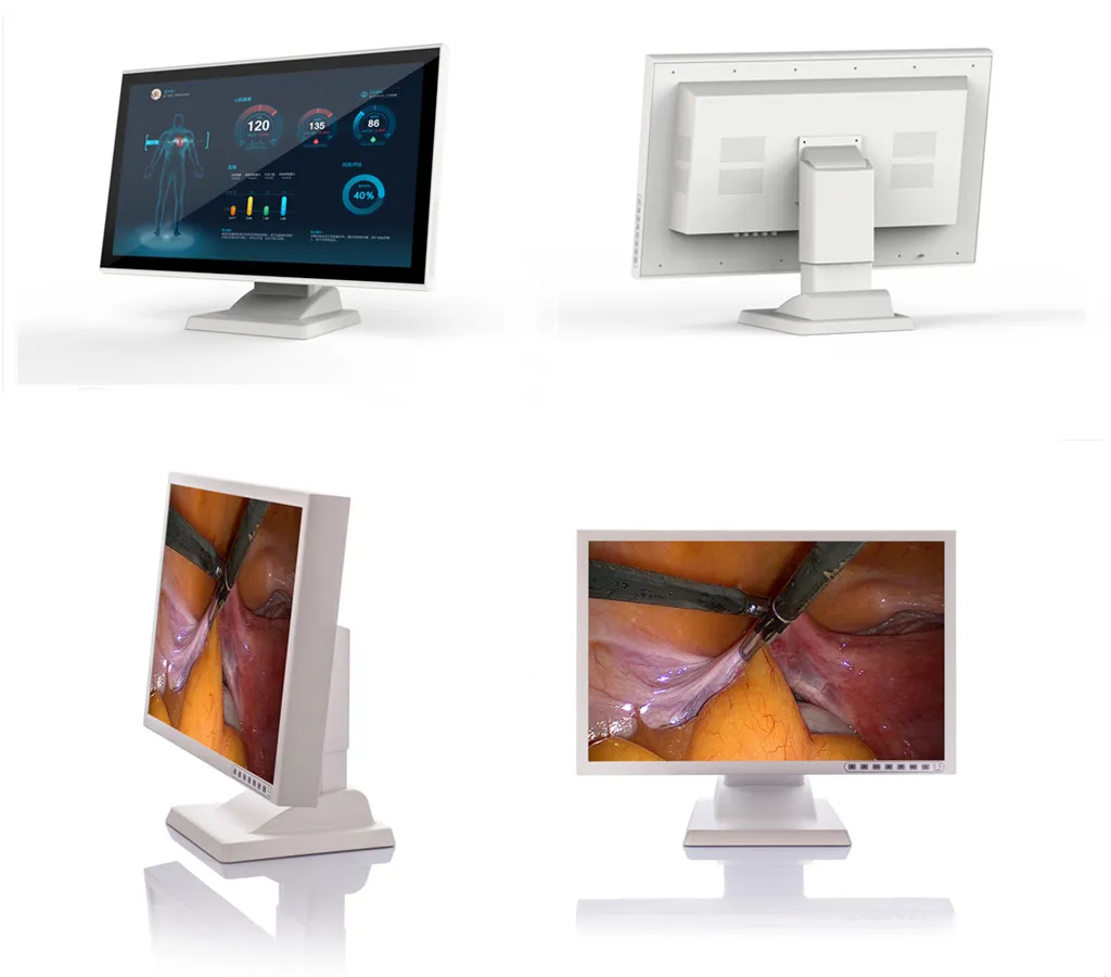 15inch Medical Monitor for Ent Imaging