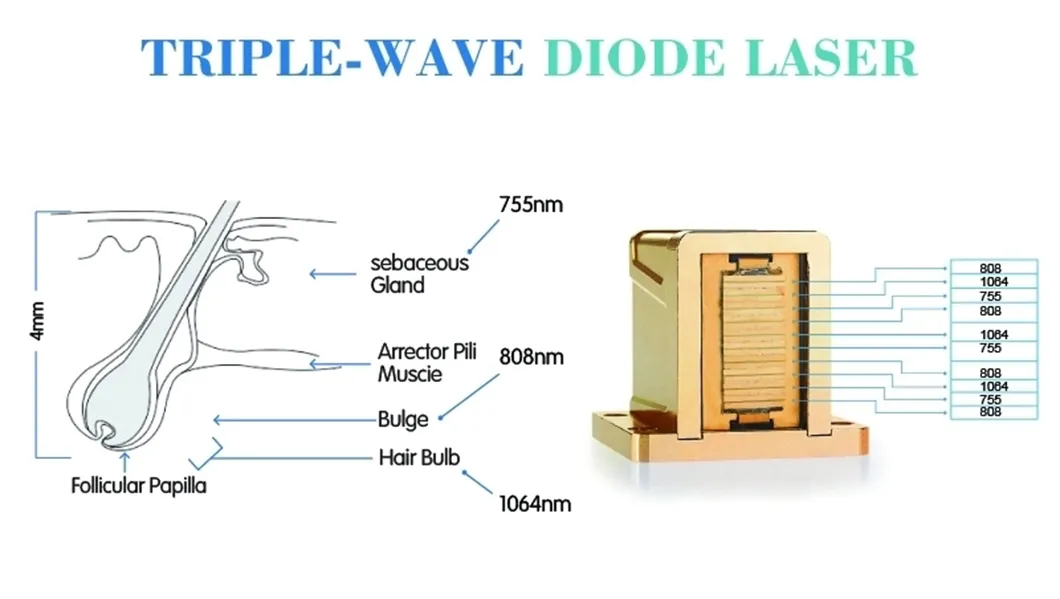 1800W Laser Depilation Machine/ 808nm Diode Laser Depilation / Pain Free Laser Machine From From Beijing Nubway