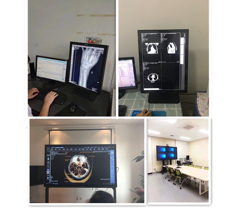 21.3′′ Mammary Imaging Display China