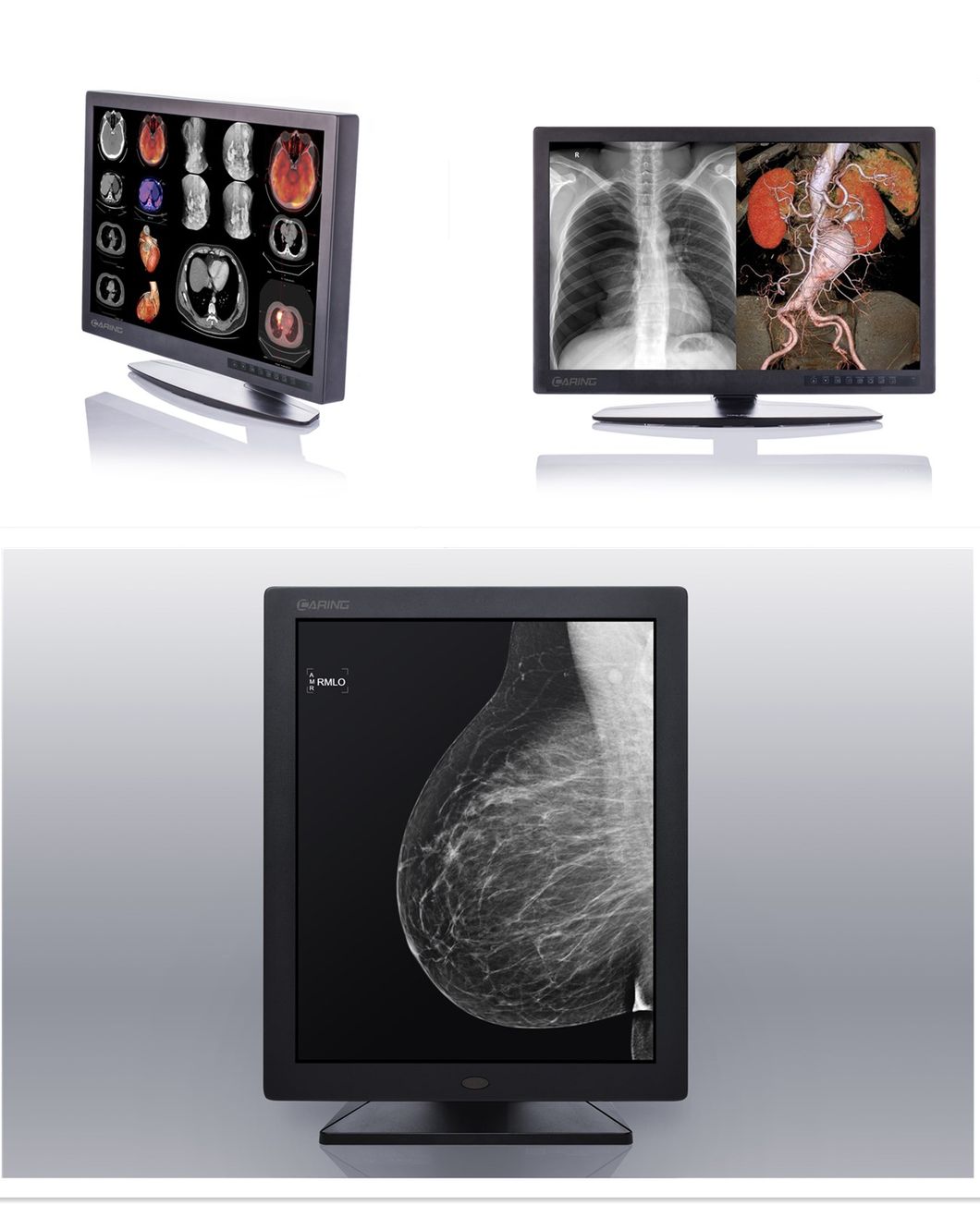 21.3′′ Mammary Imaging Display China
