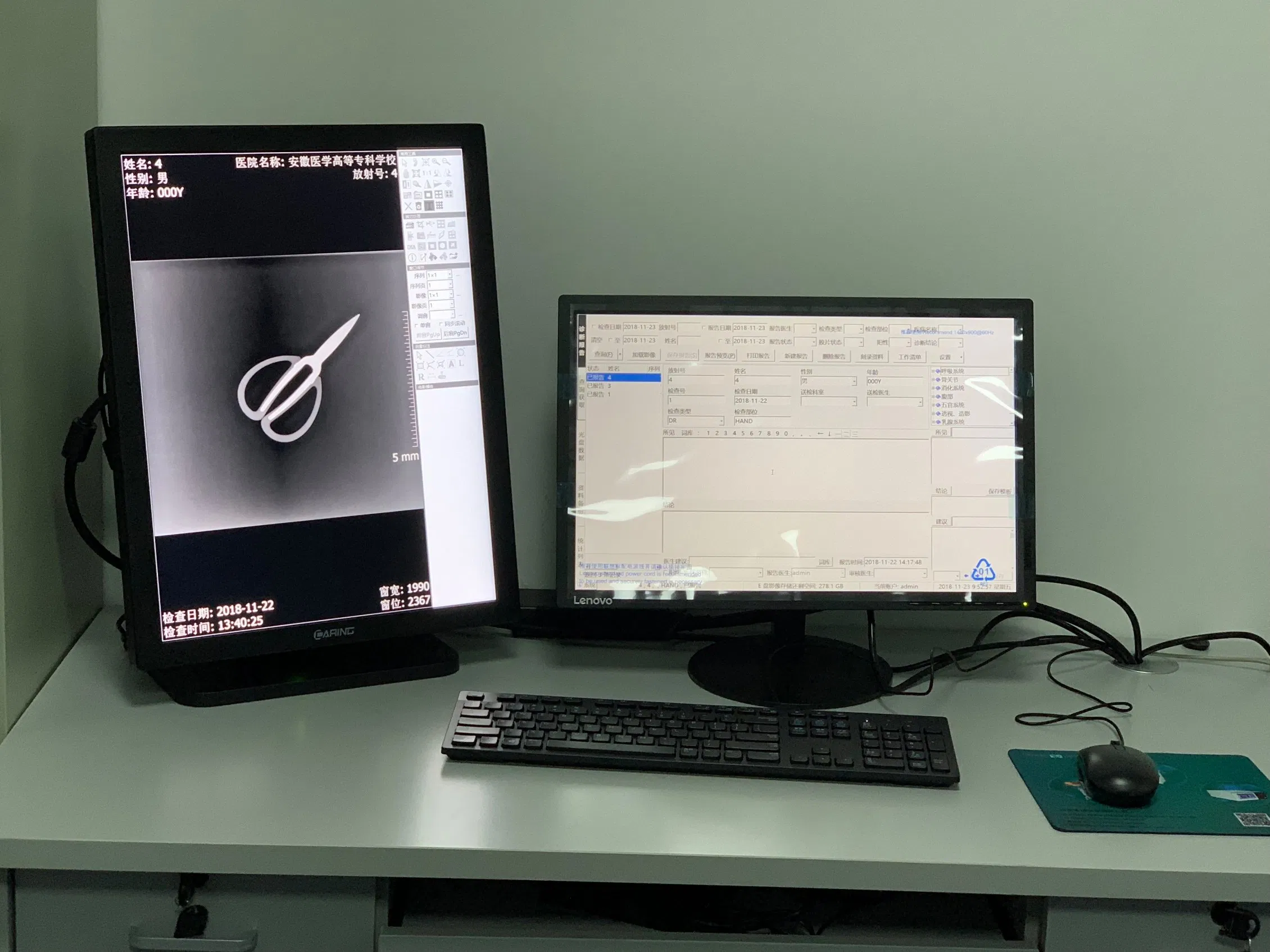 21.3' Mammary Imaging Display China