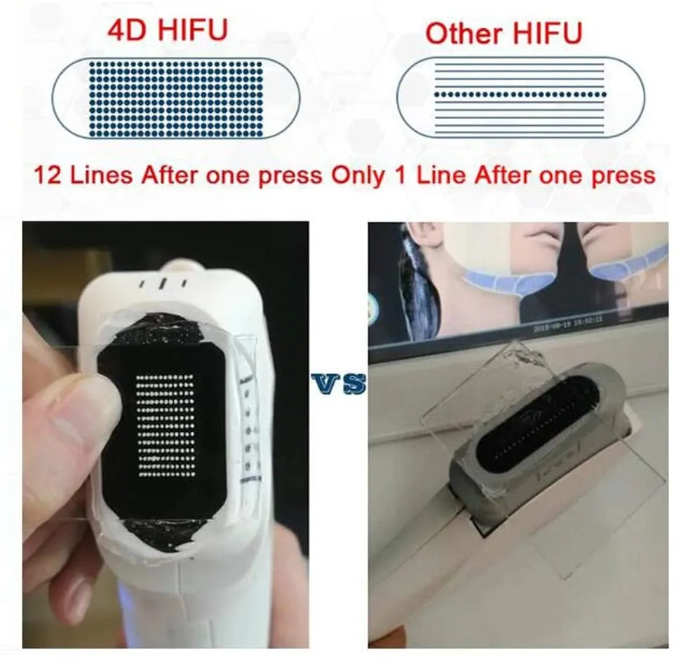 3 in 1 4D Hifu Vmax Liposonic Beauty Device for Salon Use