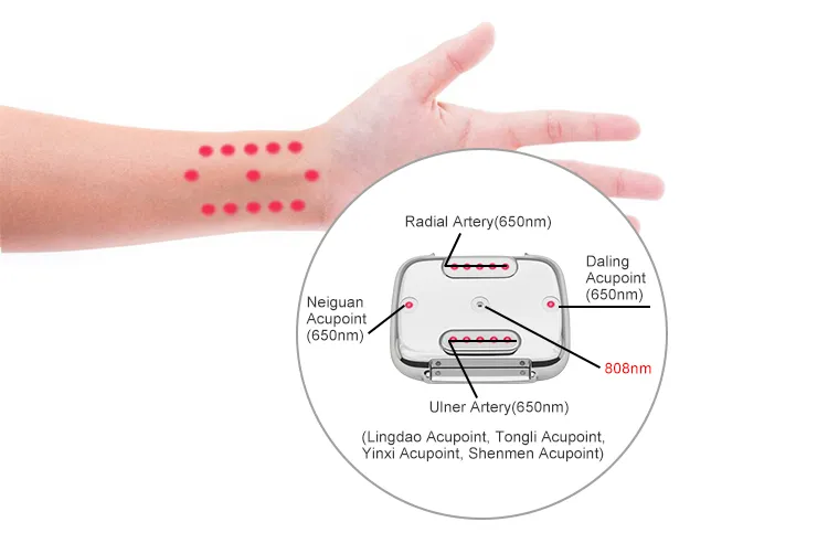3 in 1 Adjustable Cold Laser Therapy Red Light Wrist Watch Reduce Pain for Rhinitis Joint Wound