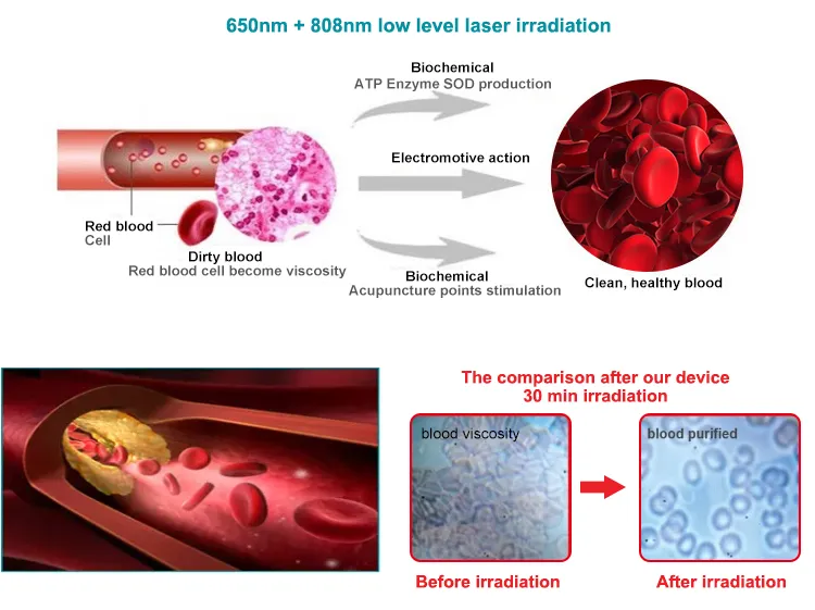 3 in 1 Adjustable Cold Laser Therapy Red Light Wrist Watch Reduce Pain for Rhinitis Joint Wound