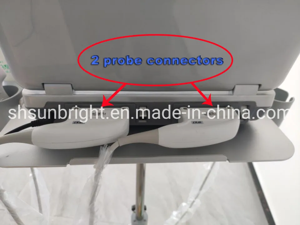 3D Full Digital 4D Veterinary Medical Best Equipment with Convex Probe