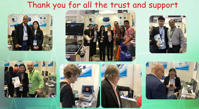 3D Full Digital 4D Veterinary Medical Best Equipment with Convex Probe