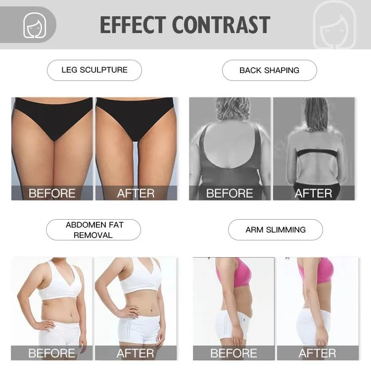 40K Weight Loss RF Vacuum Cavitation System Body Slimming Machine Ultrasound Machine Beauty Salon Equipment