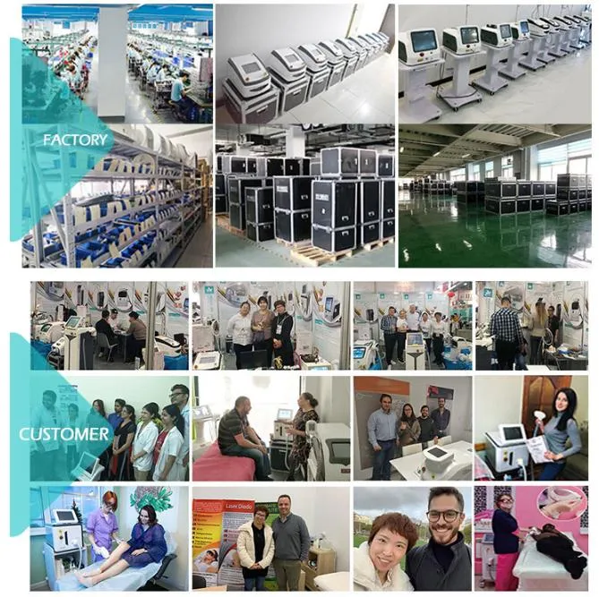 532nm 1064nm 1320nm Pigments Removal Q Switch Tattoo Removal Equipment