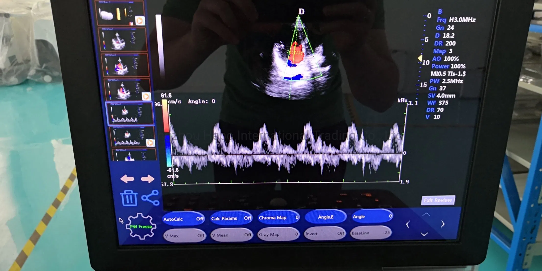 All-Purpose Portable Color Doppler Pft Diagnostic Machine (HP- UC320 )