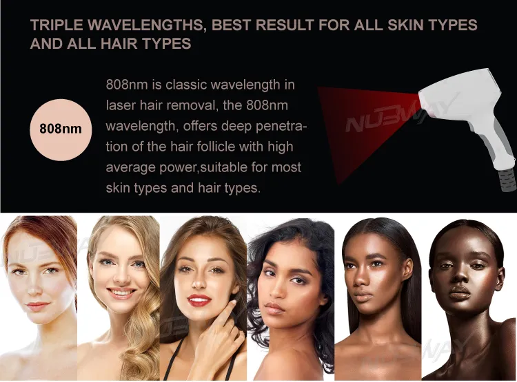 All Types Body Skin Top Quality No Pain Nubway Painlesss Permanent Depilation Professional Factory Price Soprano Laser 808nm Hair Removal Machine for Sale UK