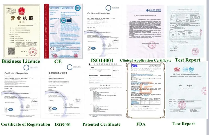 Aquaplast Nose Splint Thermoplastic Splint Sheets for Nose Surgery