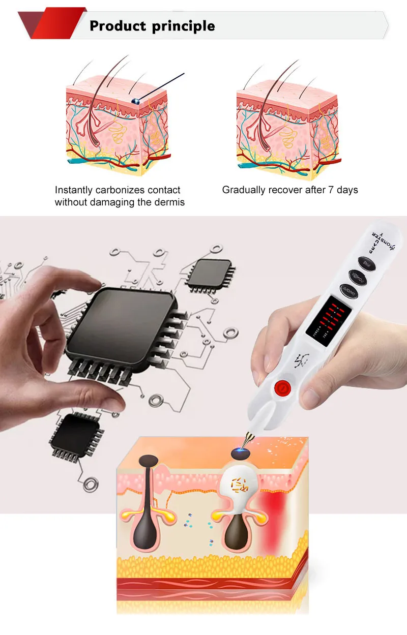 Beauty Laser Spot Freckle Mole Remover Plasma Pen