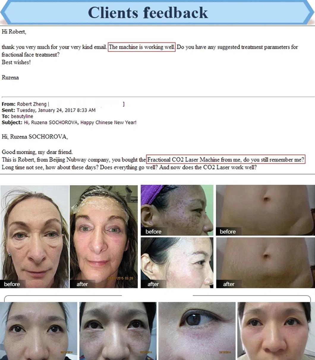 Beauty Machine Clinic Use Chloasmas Ance Removal Non Ablative Fractional Laser for Clinic Salon and Hospital