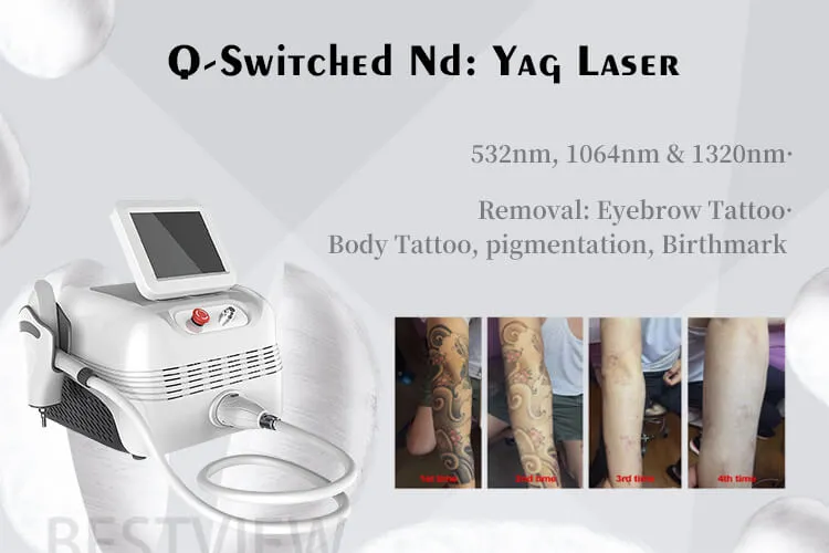 Professional Q-Switched ND YAG Laser Tattoo Removal Machine Beauty Salon Equipment