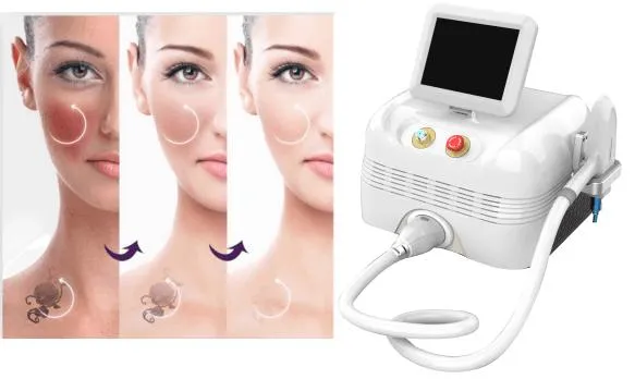 Professional Q-Switched ND YAG Laser Tattoo Removal Machine Beauty Salon Equipment