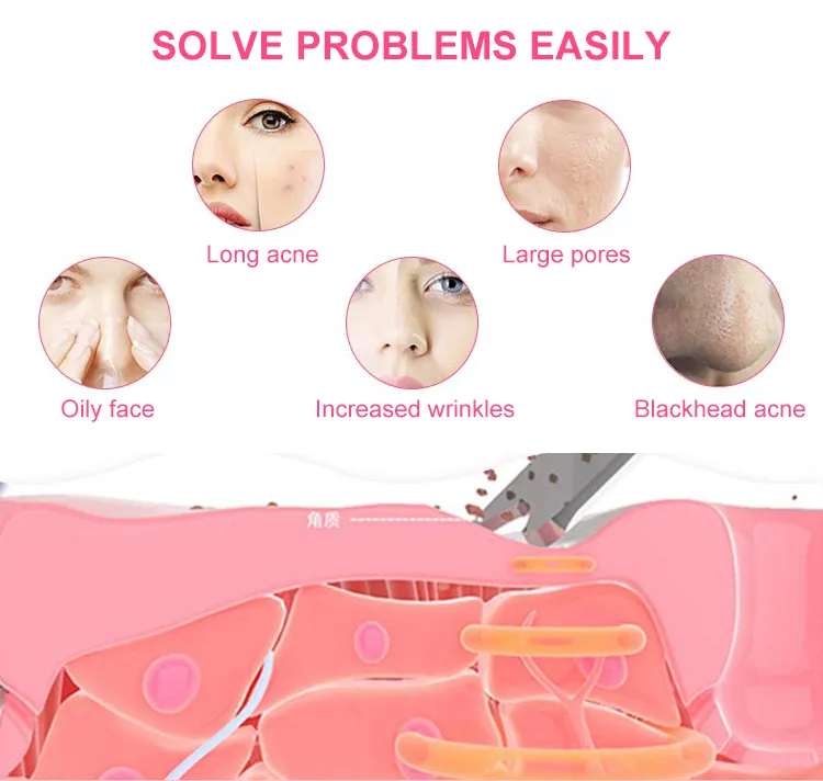 Black Promote Skin Health, Facial Renewal Skin Scrubber