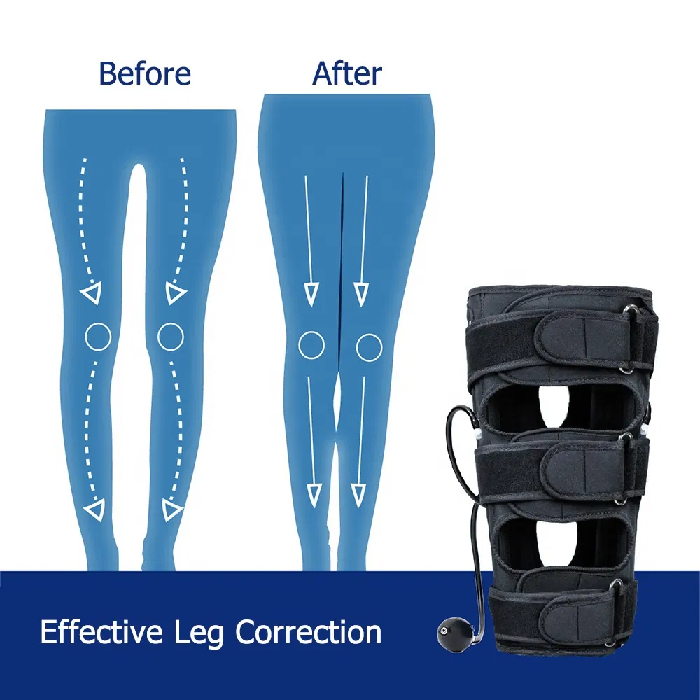 Bowed Legs Knee Straightening Posture Corrector Band Effective O/X Type Leg Correction Belt for Adults Children