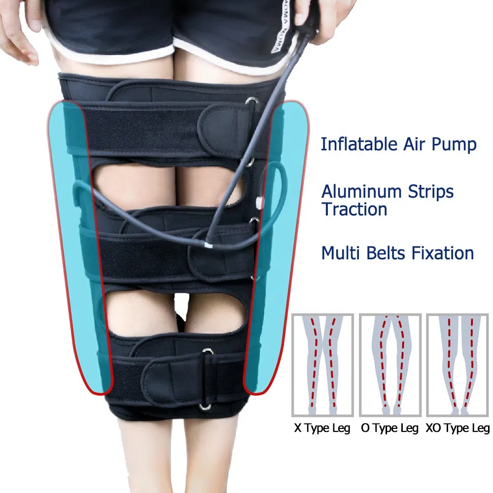 Bowed Legs Knee Straightening Posture Corrector Band Effective O/X Type Leg Correction Belt for Adults Children