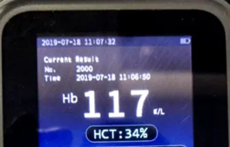 CE Approved H7 Professional Poct Hemoglobin Analyzer Hba1c Meter for Medical Use