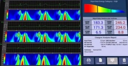 CE Approved Long Life 10 Channel Touch Screen ECG Device with Built-in Printer for Medical Supply