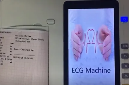 CE Approved Long Life 10 Channel Touch Screen ECG Device with Built-in Printer for Medical Supply