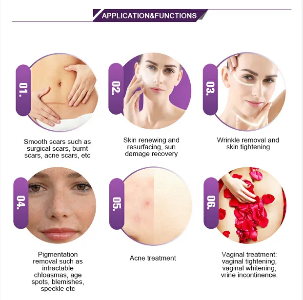 CO2 Fractional Laser with CO2/Fractional/ Virginal Treatment Systems