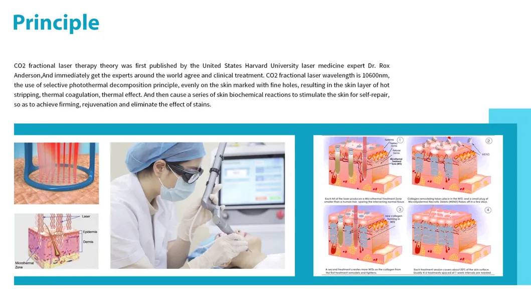 Consultant Be Medical Laser TUV FDA Approved Scar Removal Skin Resurfacing Laser Vaginal Tightening CO2 Fractional