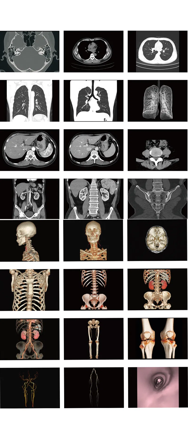CT Scanner 16-Slice HD Spiral Medsinglong Mslctx04
