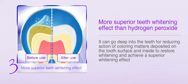 Custom Package Tooth Polishing Whiting Teeth Stripes