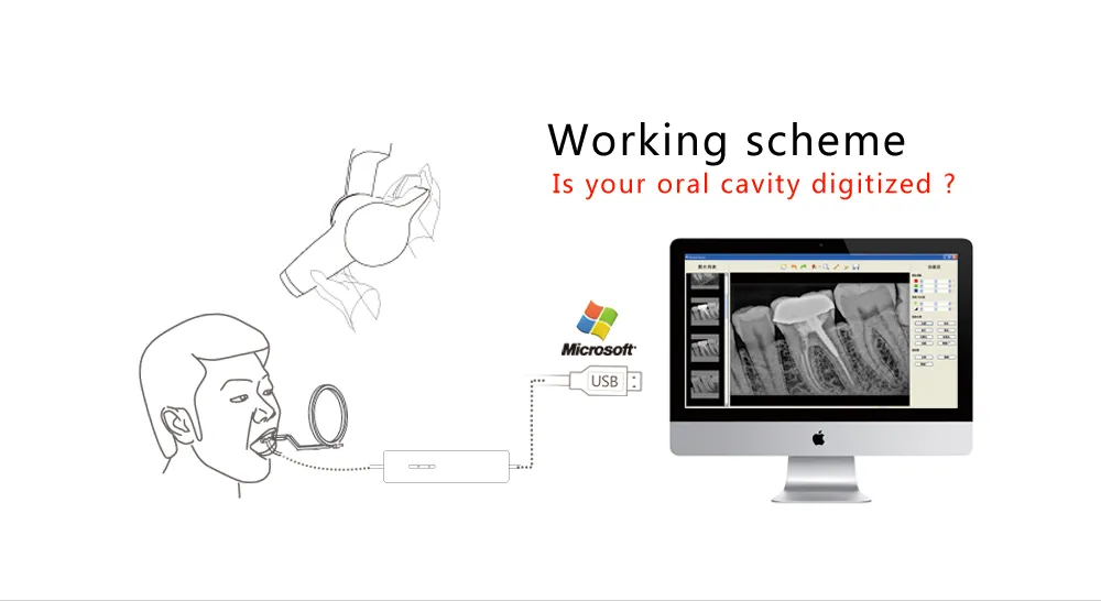 Dental Digital Intra Oral X Ray Sensor Hdr 500 Best Price