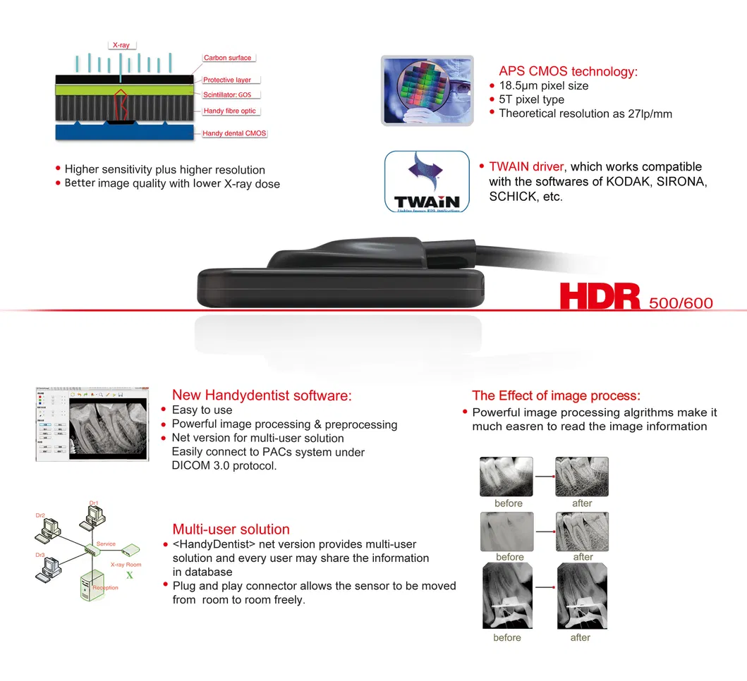 Dental Digital Intra Oral X Ray Sensor Hdr 500 Best Price