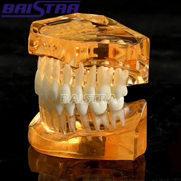 Dental Standard Teeth Model Teeth Removable Model Zyr-7006-1