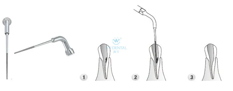 E4dt for EMS&Woodpecker Whiting Machine