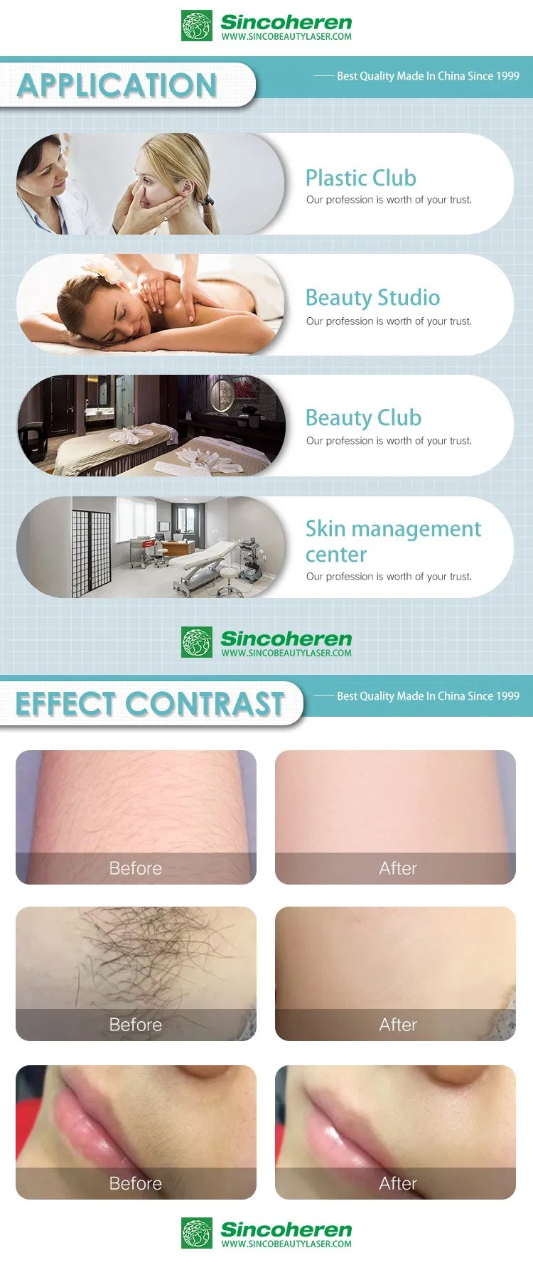 FDA Alexandrite Laser for Hair Removal 755 808 1064 Diode Machine Price