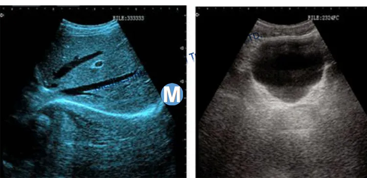 Full Digital Professional Digital Ultrasound Scanner Trolley Price