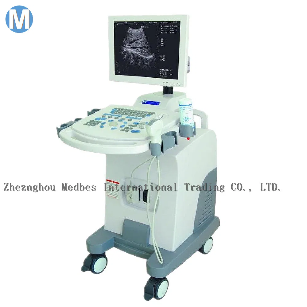 Full Digital Professional Digital Ultrasound Scanner Trolley Price