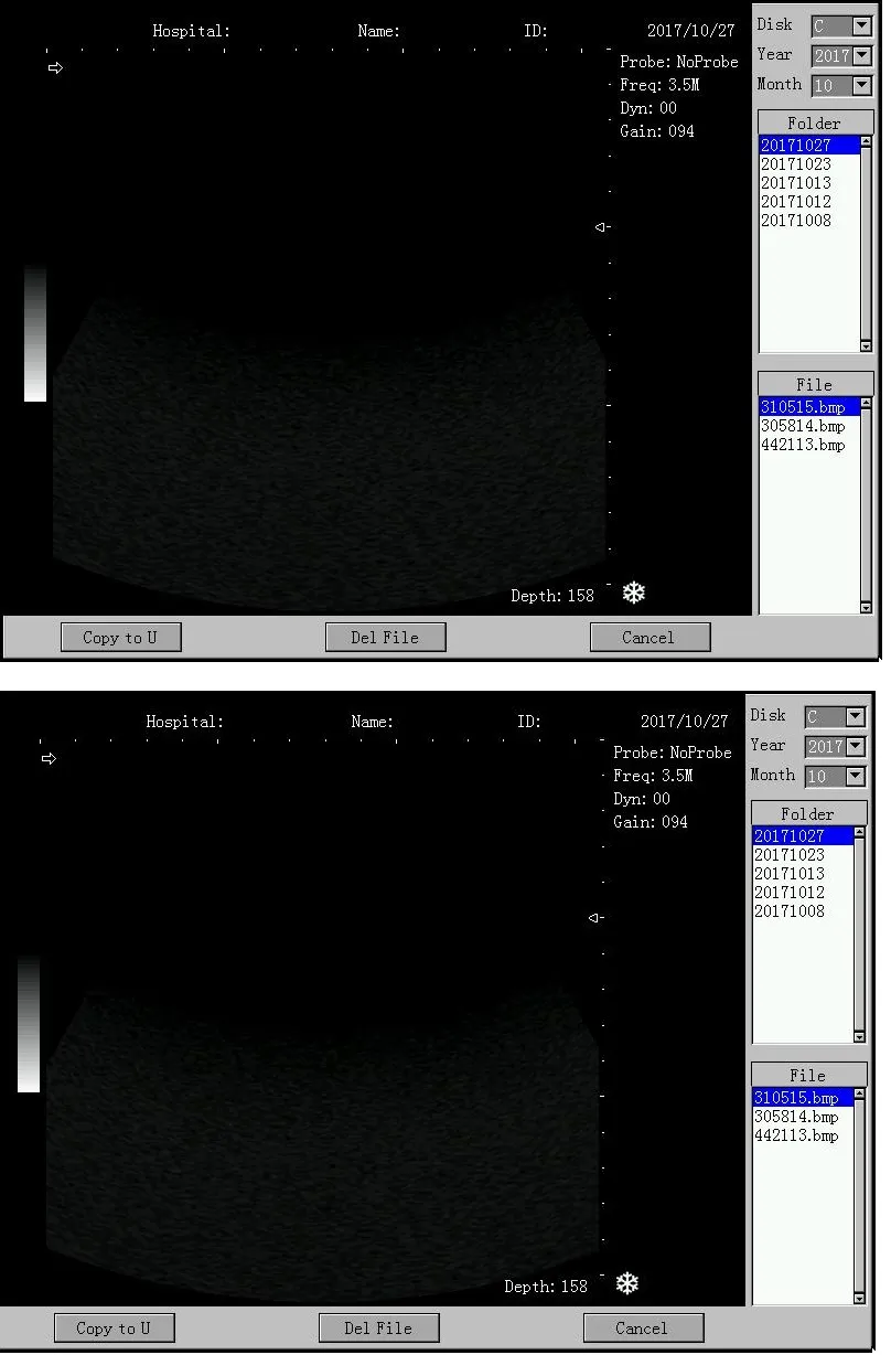 Full Digital Professional Digital Ultrasound Scanner Trolley Price