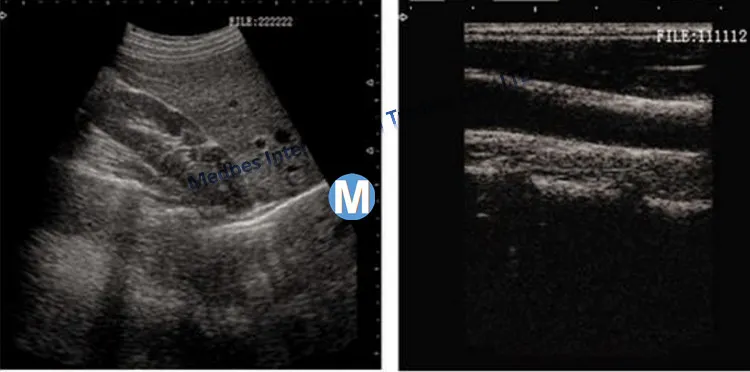 Full Digital Professional Digital Ultrasound Scanner Trolley Price