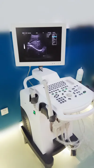 Full Digital Professional Digital Ultrasound Scanner Trolley Price