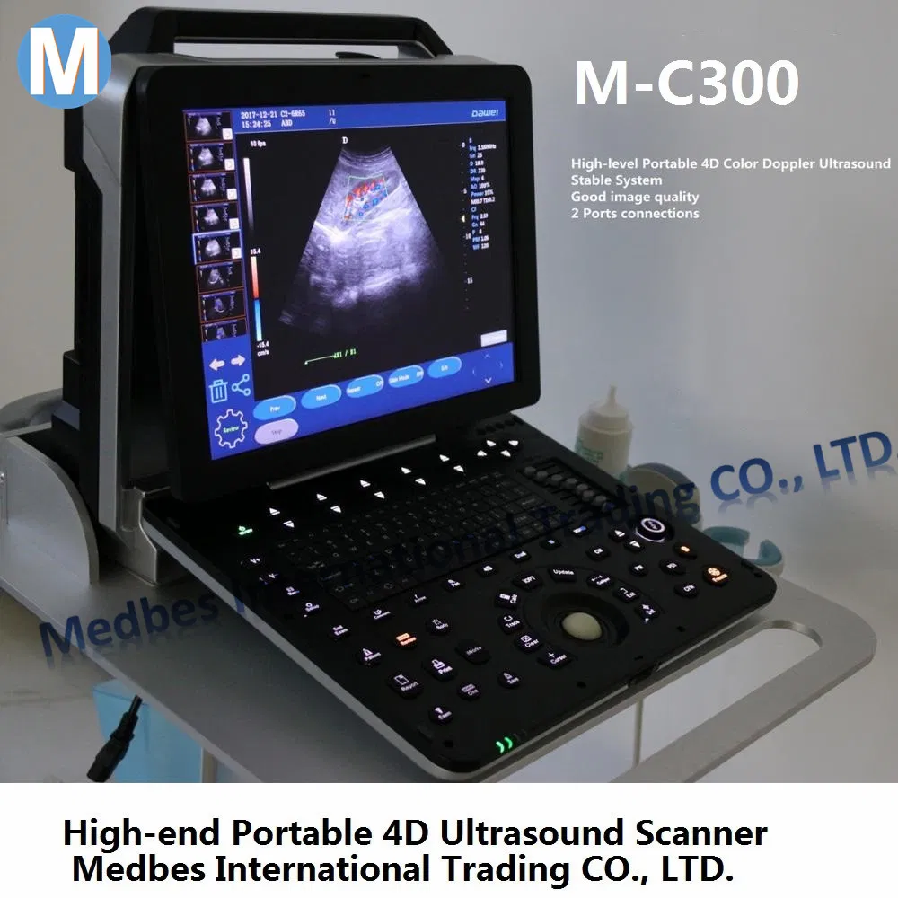 Full-Digital Tissue Harmonic Imaging (THI) 4D Color Ultrasound Scanner