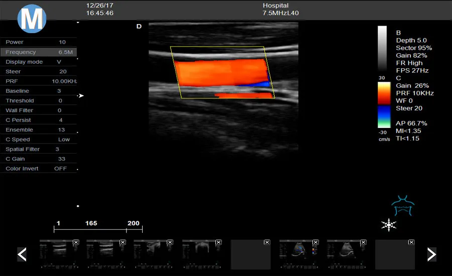 Full-Digital Tissue Harmonic Imaging  (THI) 4D Color Ultrasound Scanner