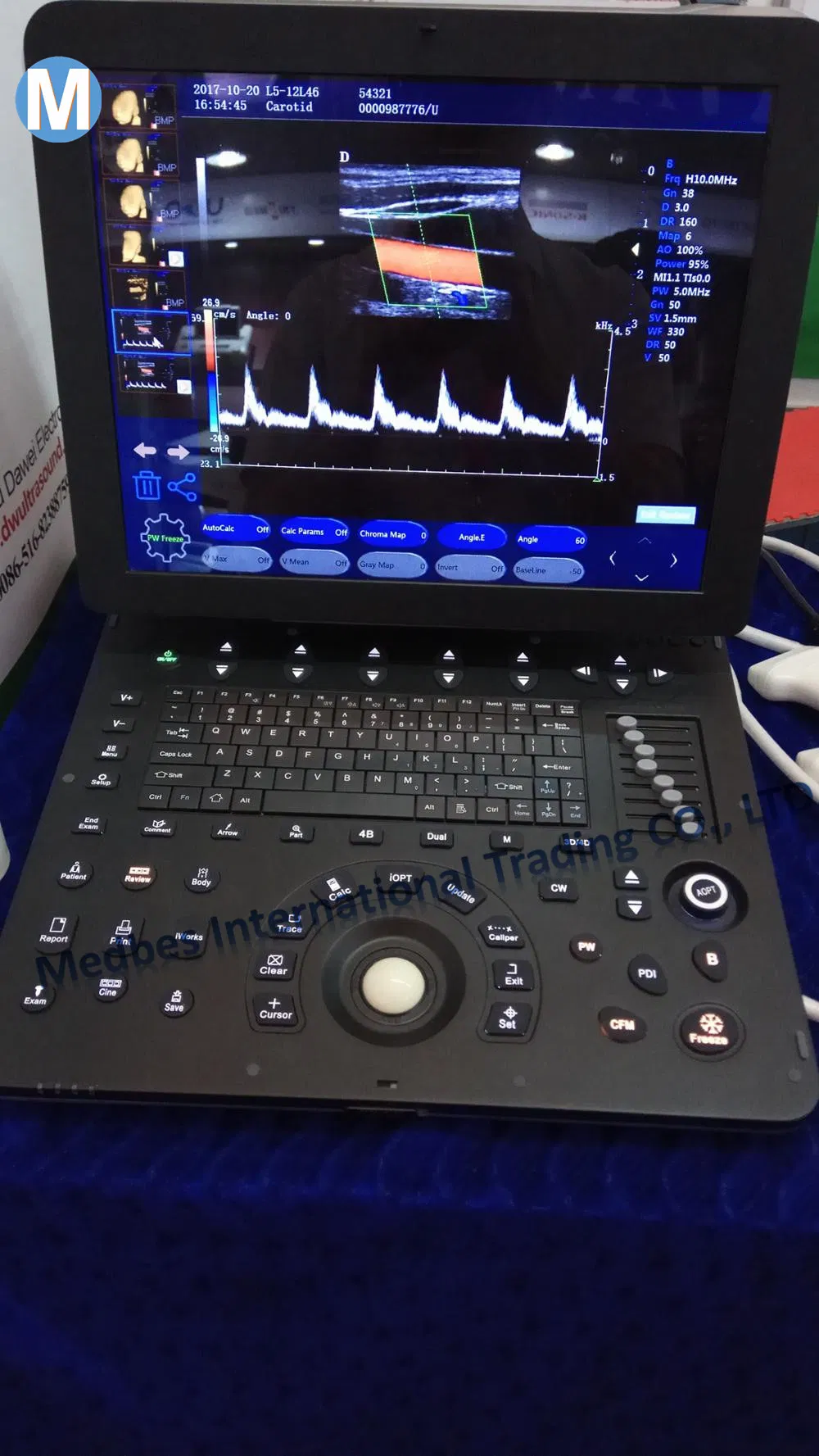 Full-Digital Tissue Harmonic Imaging  (THI) 4D Color Ultrasound Scanner