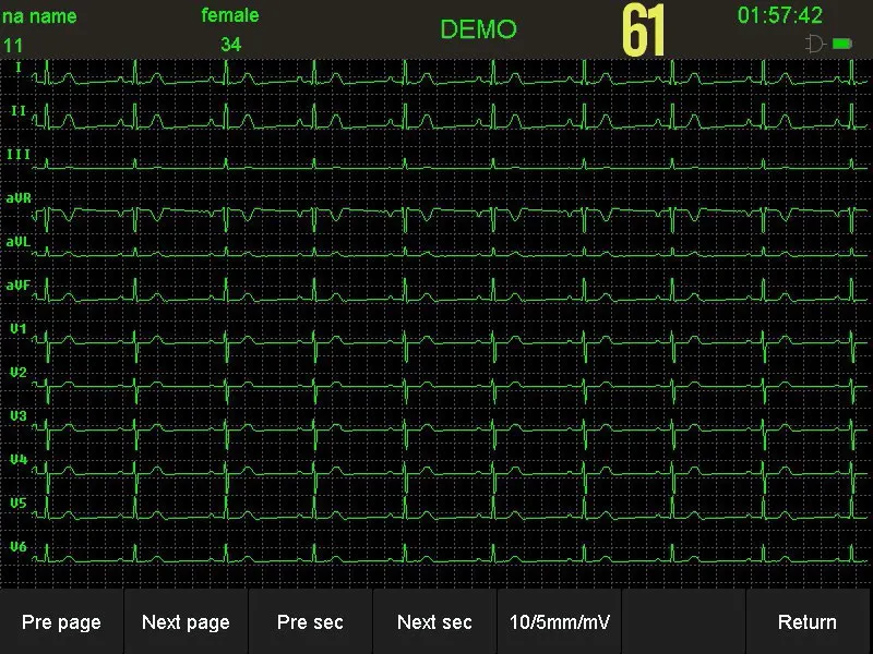 Full Touch Screen 8" LCD 12 Channel ECG Machine