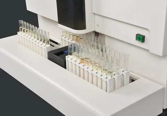 Fully Automatic Touch Screen Urinary Sediment Analysis System Urine Analyzer for Labpratory