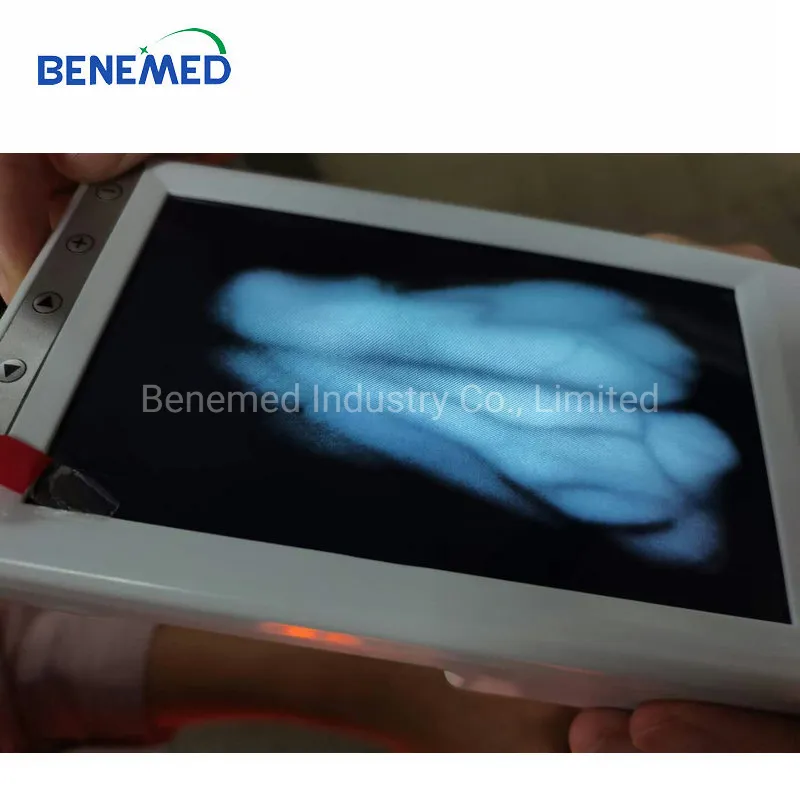 Good Quality LED Rechargeable Battery Handle IR Vein Finder