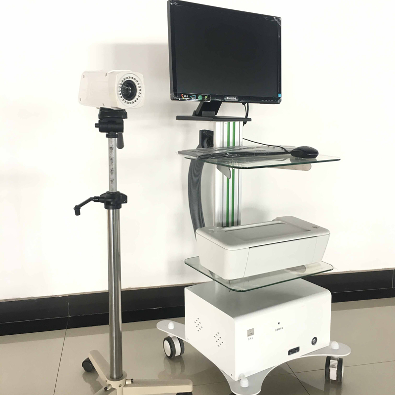 Gynecology and Obstetrics Equipment Portable Electronic Digital Colposcope