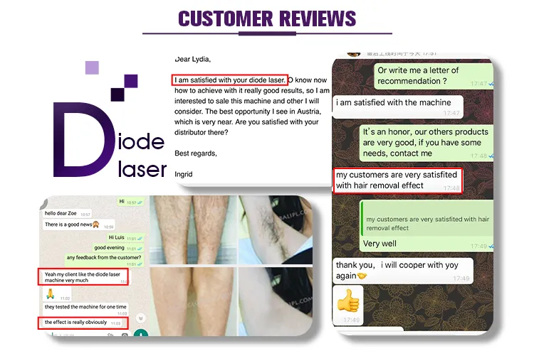 High Quality Painless Permanent Hair Removal 808 Laser Hair Removal Machine Prices for Sale