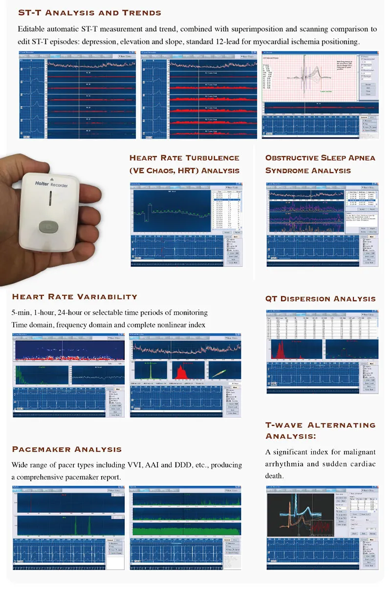 Holter ECG Device ECG 24 Hour Holter Monitor--Heartrec Lite