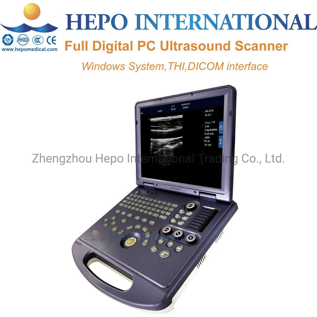 Hospital Portable Medical Ultrasound Scanner 3D 4D Color Doppler Machine